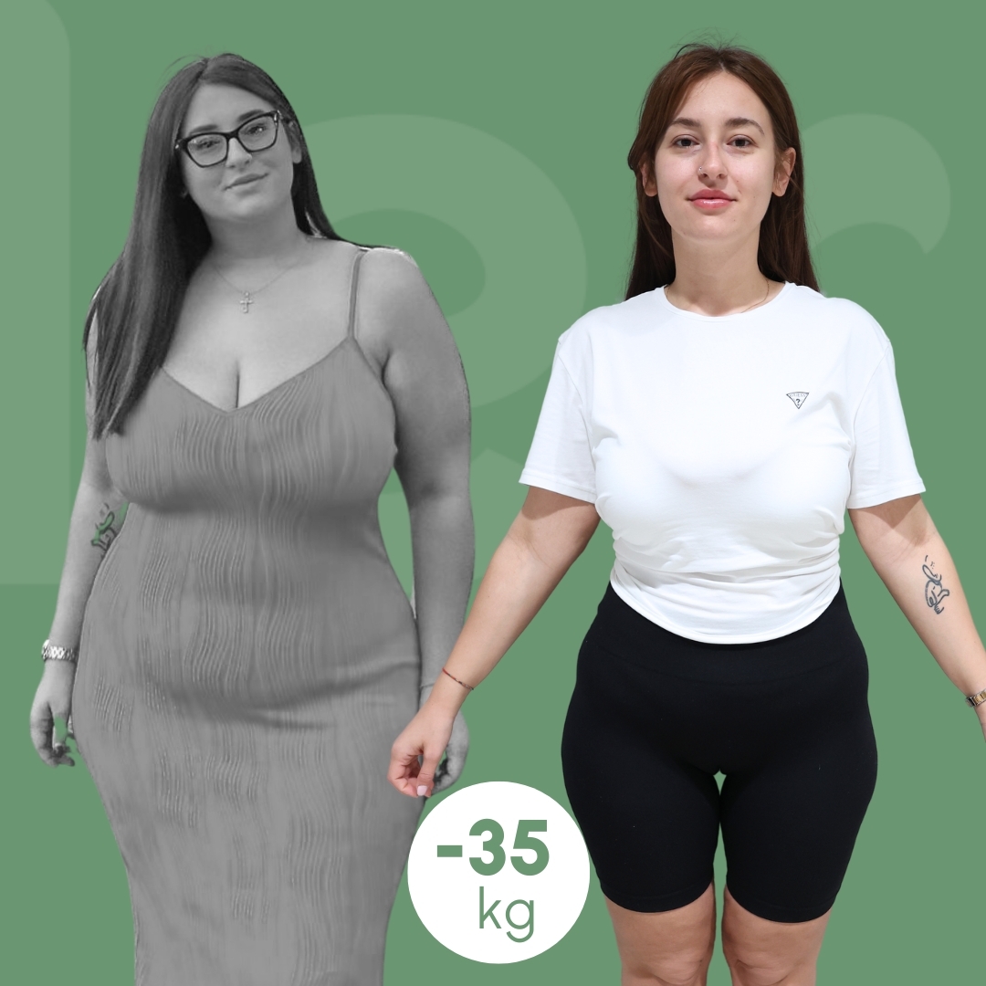 Baloni Gastrik Dermolife 24