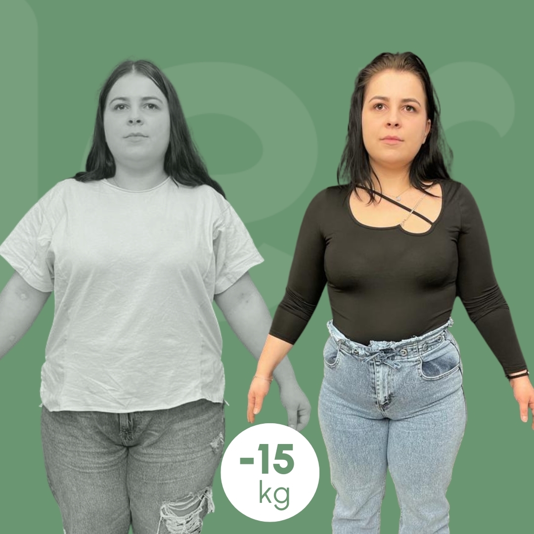 Baloni Gastrik Dermolife 23