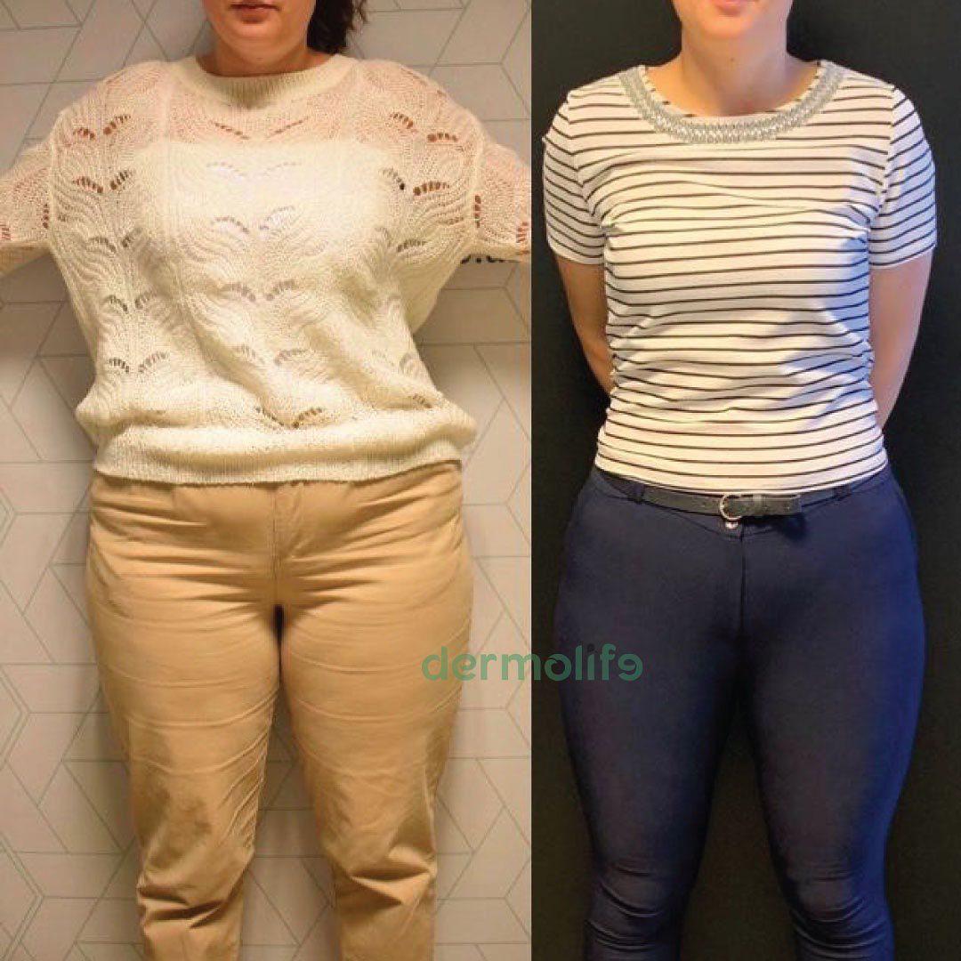Dieta Ushqimore
