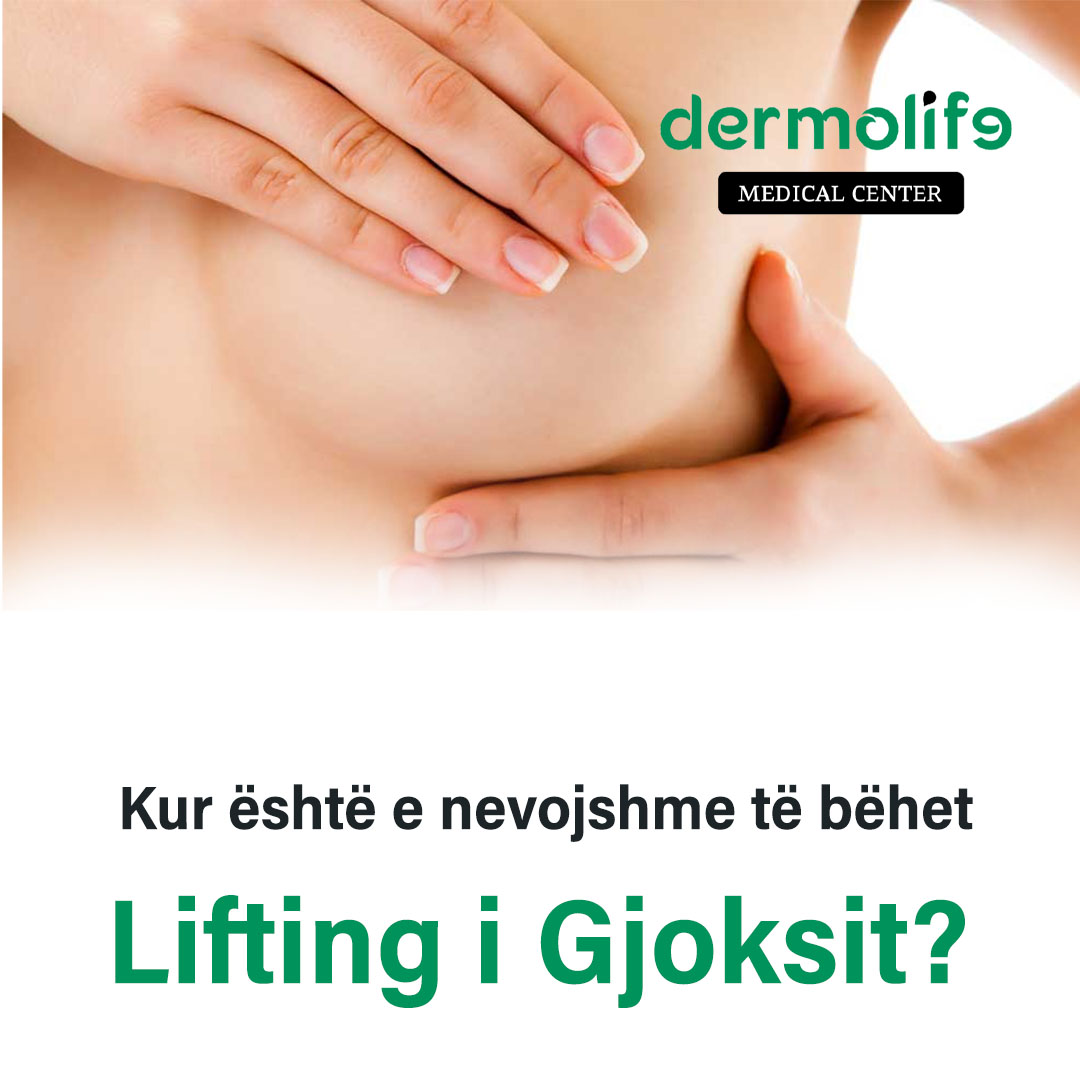 Kur behet lifting i gjoksit?