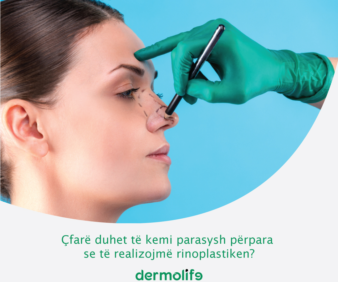 Cfare duhet te kemi parasysh perpara se te realizojme rinoplastiken?