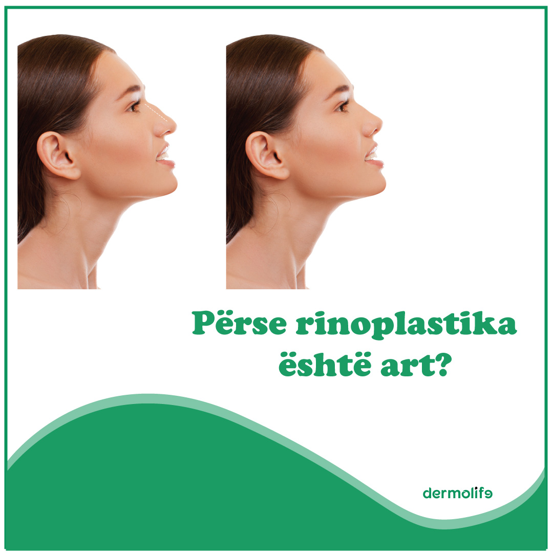 Perse rinoplastika eshte art ne vetvete?