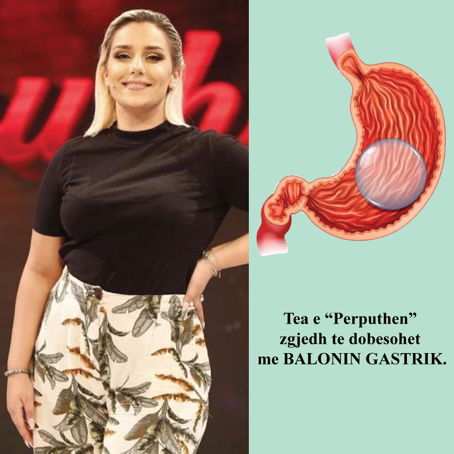 Tea e “Perputhen” zgjedh te dobesohet me balonin gastrik.