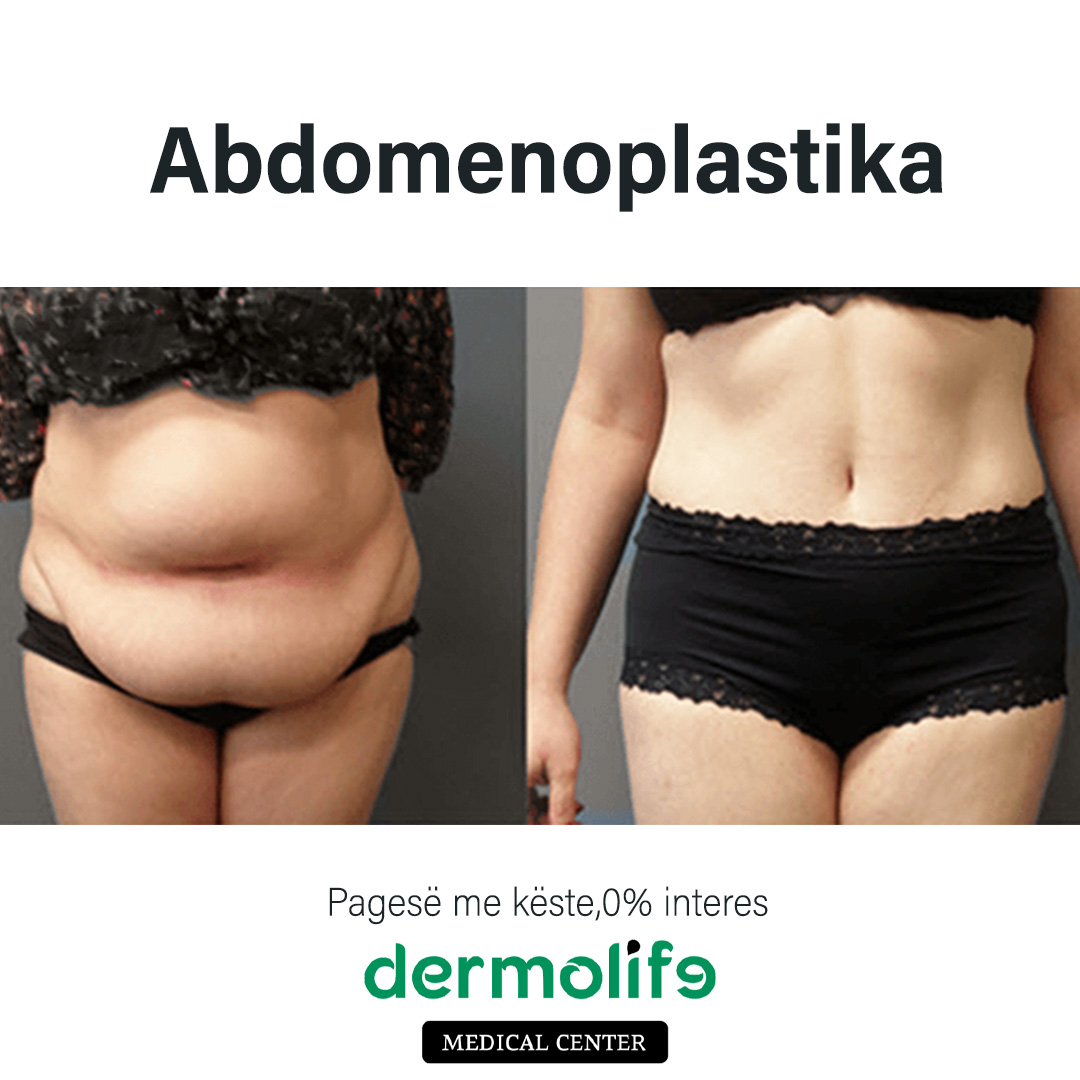 rimodelimi i barkut pamja 11 dermolife