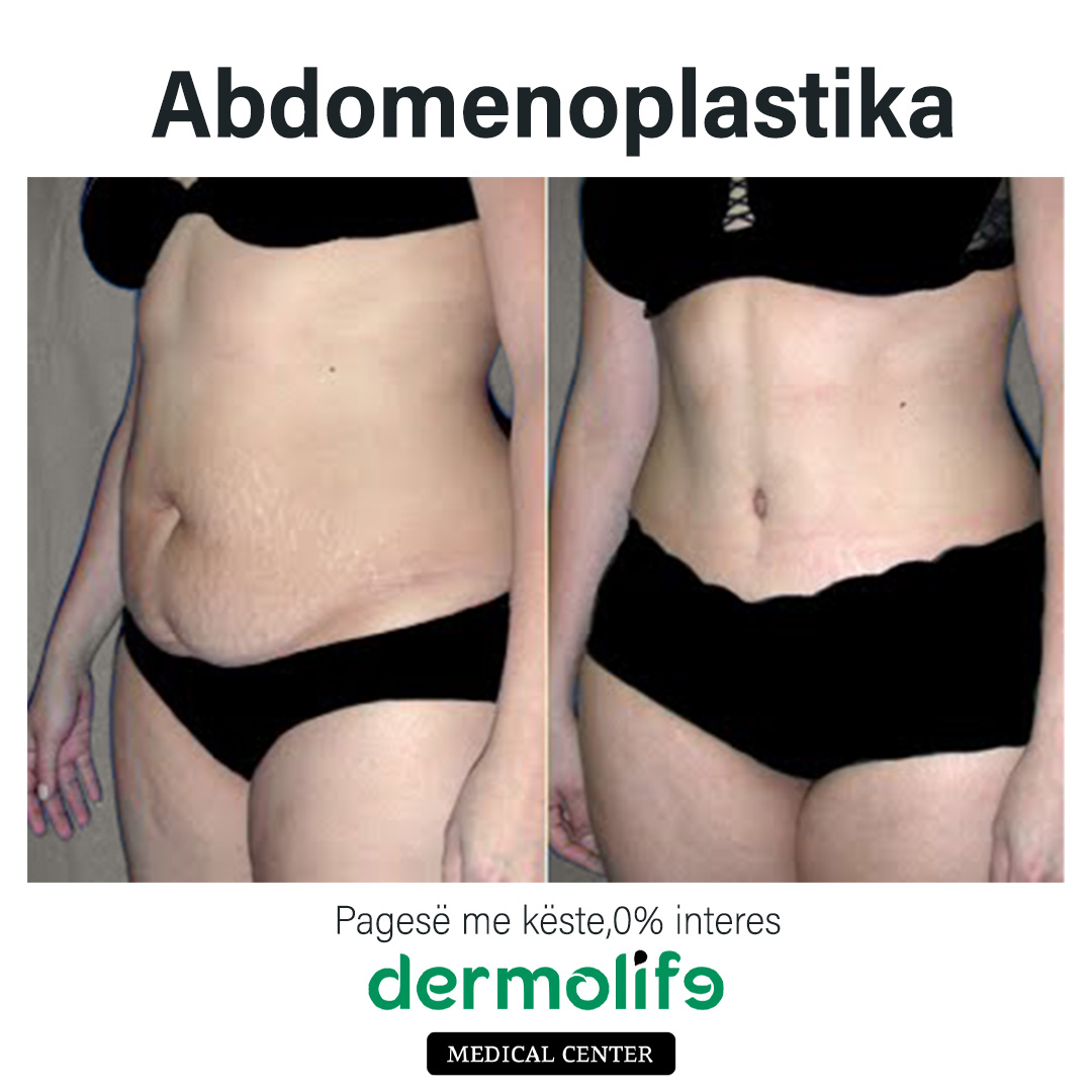 rimodelimi i barkut pamja 10 dermolife
