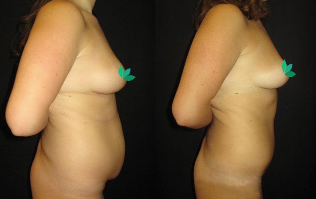 rimodelimi i barkut pamja 8 dermolife
