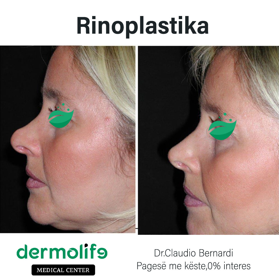 rimodelimi i hundes pamja 11 dermolife